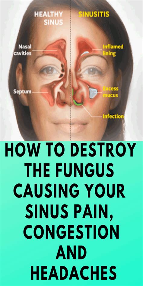 How do you drain a severe sinus?