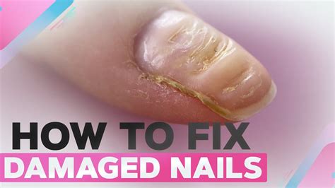 How do you fix a damaged nail bed?