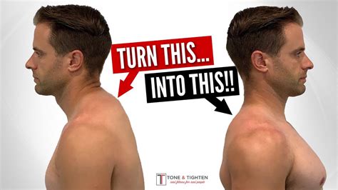 How do you fix a neck hump?