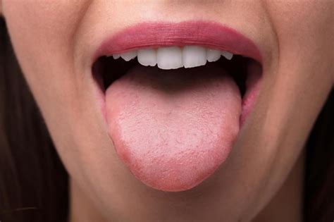 How do you fix a sore tongue from too much sour?
