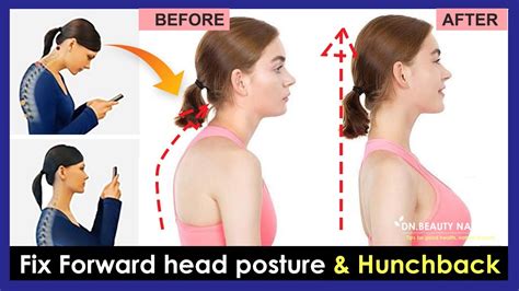 How do you fix a tilted head posture?