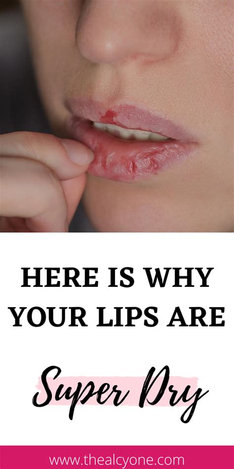 How do you fix dry lips?