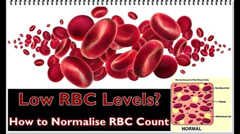 How do you fix low RBC?