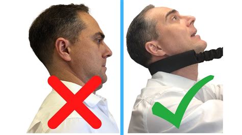 How do you fix military neck exercise?