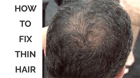 How do you fix thinning hair?