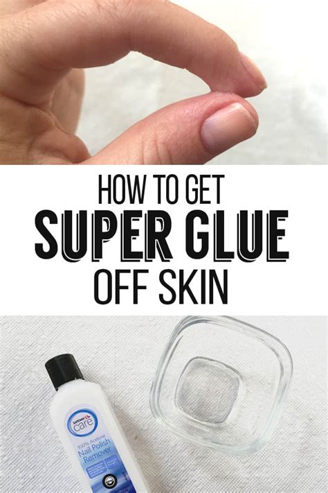 How do you get dried super glue off your skin?