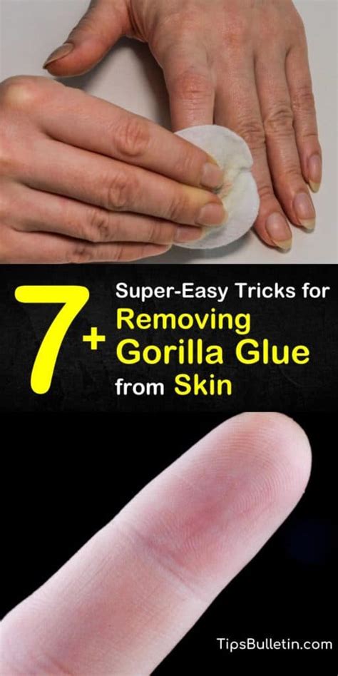 How do you get hot glue off your skin?