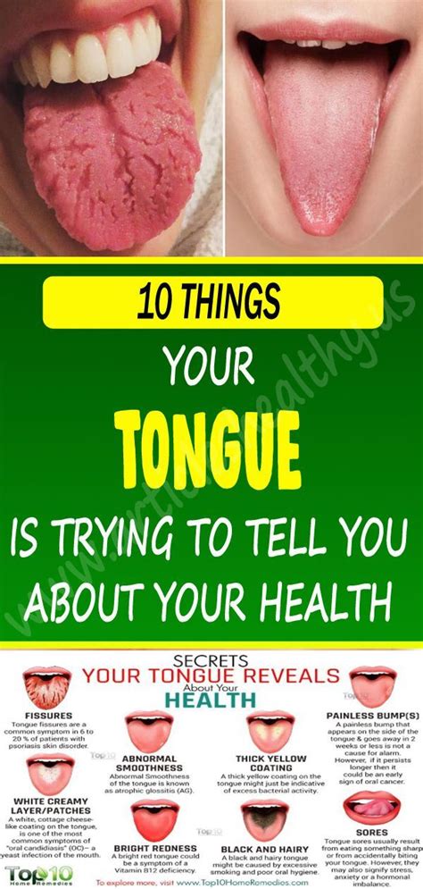 How do you get rid of a green tongue from candy?