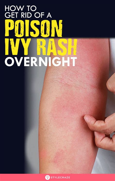 How do you get rid of a rash overnight?
