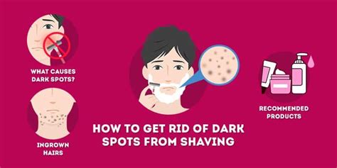 How do you get rid of black spots after shaving?