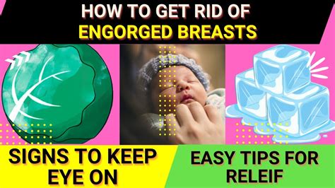 How do you get rid of breast engorgement after abortion?