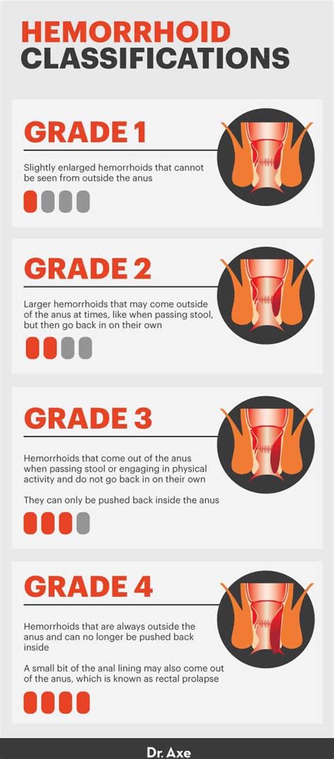 How do you get rid of grade 4 hemorrhoids?