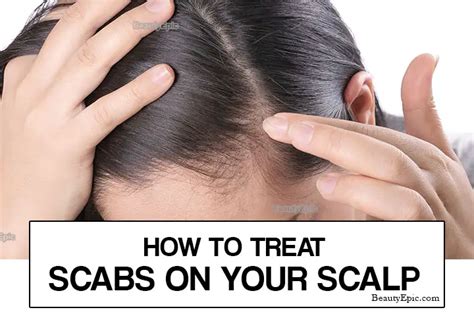 How do you get rid of hard scabs on your scalp?