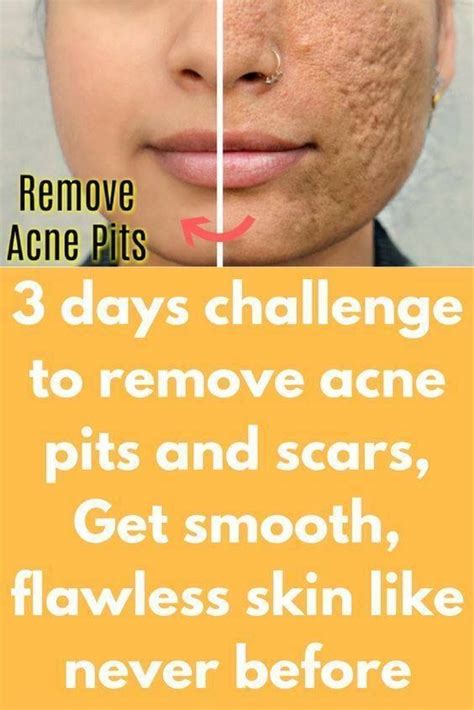 How do you get rid of holes in your face naturally?
