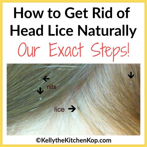 How do you get rid of mites in your hair naturally?