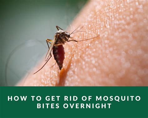 How do you get rid of mosquito bites overnight?