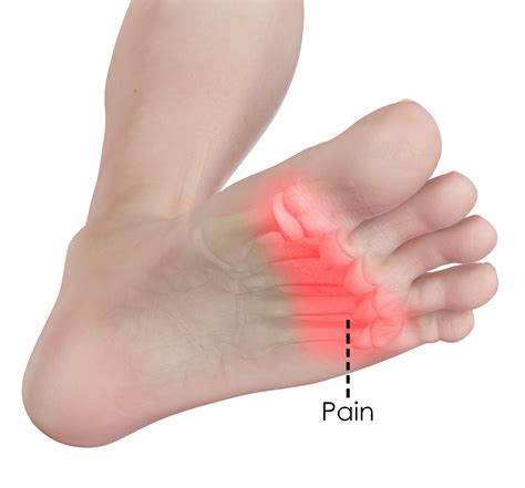 How do you get rid of pain in your left foot?