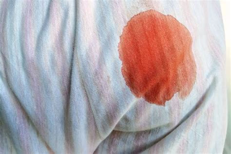 How do you get rid of period blood stains?