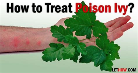 How do you get rid of poison oak rash fast?