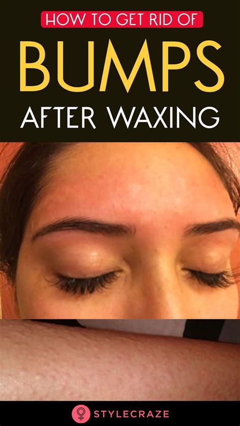 How do you get rid of redness after waxing?