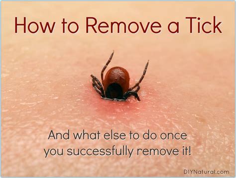 How do you get rid of ticks on humans?