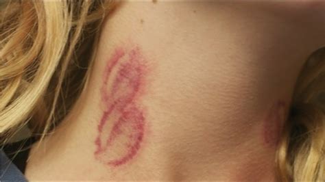 How do you give a hickey on your breast?