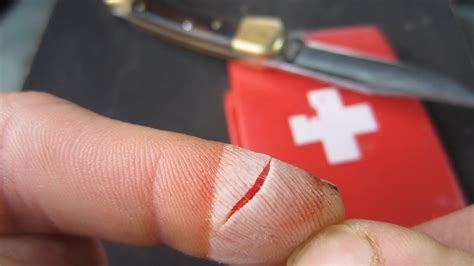 How do you heal a deep cut on your finger without stitches?