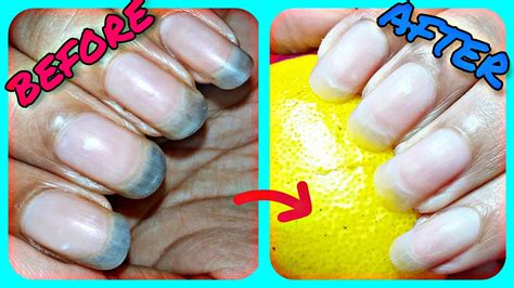 How do you hydrate your nails?