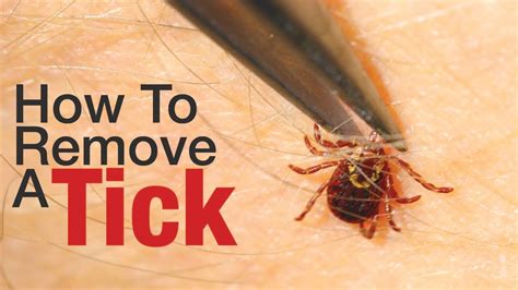 How do you kill ticks easily?