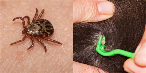 How do you know if a tick is inside you?