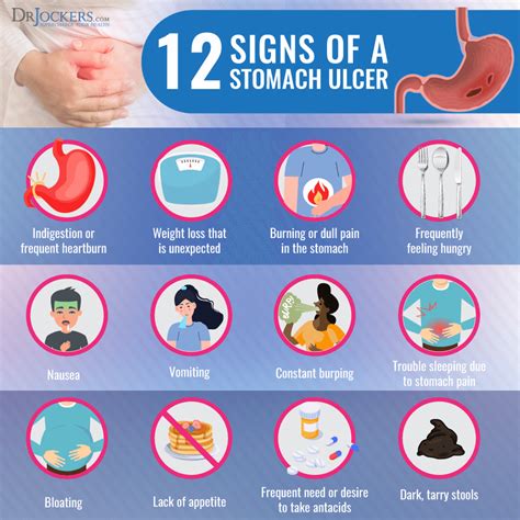 How do you know if you have an ulcer from stress?