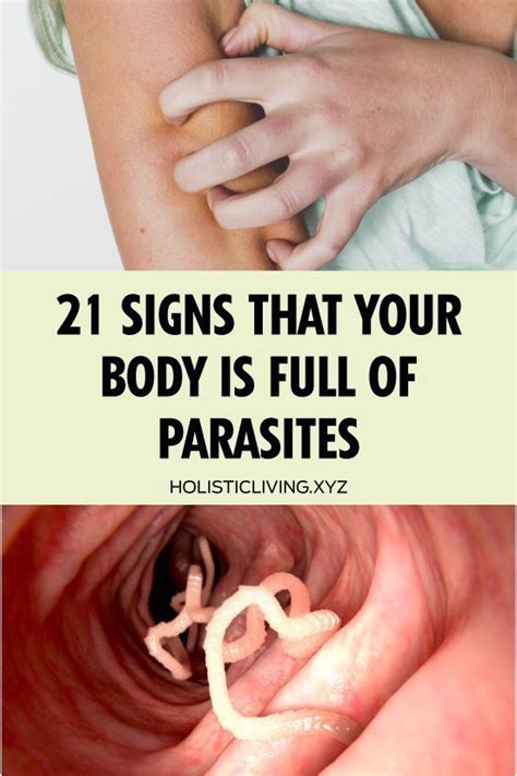 How do you know if your body is full of parasites?