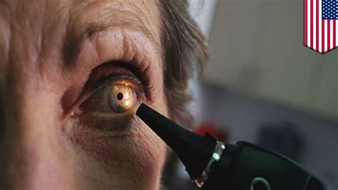 How do you know if your eyes are permanently damaged?