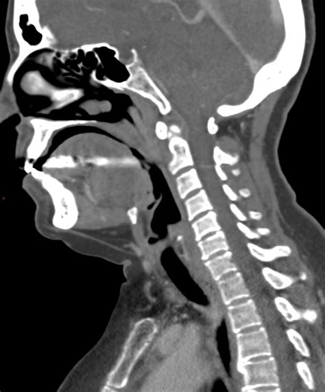 How do you know if your neck is normal?