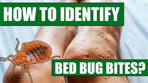 How do you know what is biting you in bed?