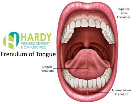 How do you know when your frenulum is healed?