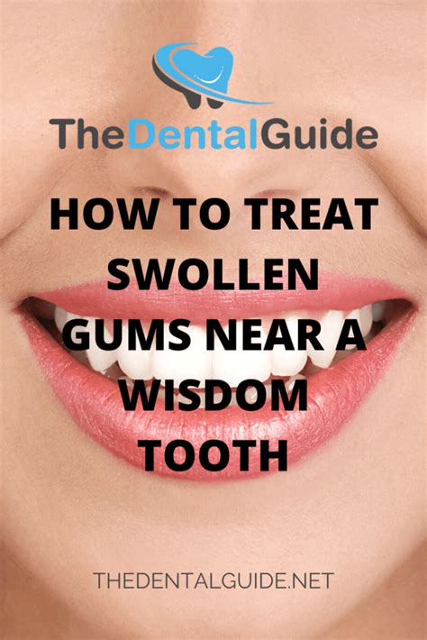 How do you make wisdom teeth swelling go down overnight?