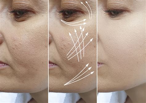 How do you make your face look younger in your 60s?