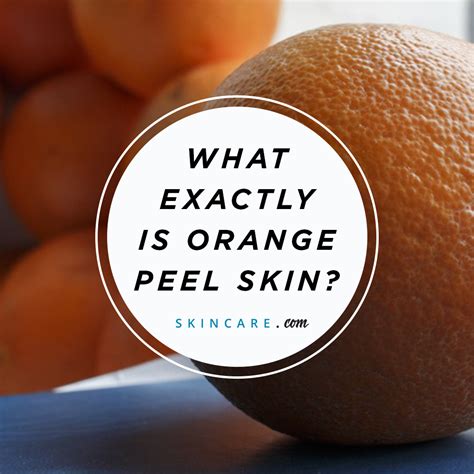 How do you prevent orange skin?