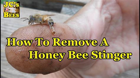 How do you remove a bee stinger you can't see?