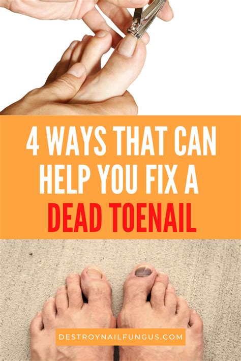 How do you remove a dead nail?