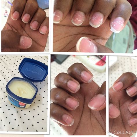 How do you remove acrylic nails with Vaseline?