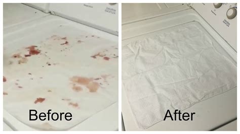 How do you remove old blood stains from sheets?