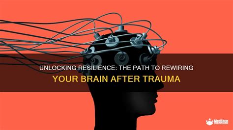 How do you rewire your brain after trauma?