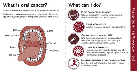 How do you rule out mouth cancer?