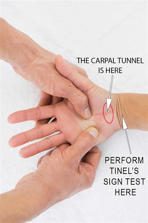 How do you self test for carpal tunnel?