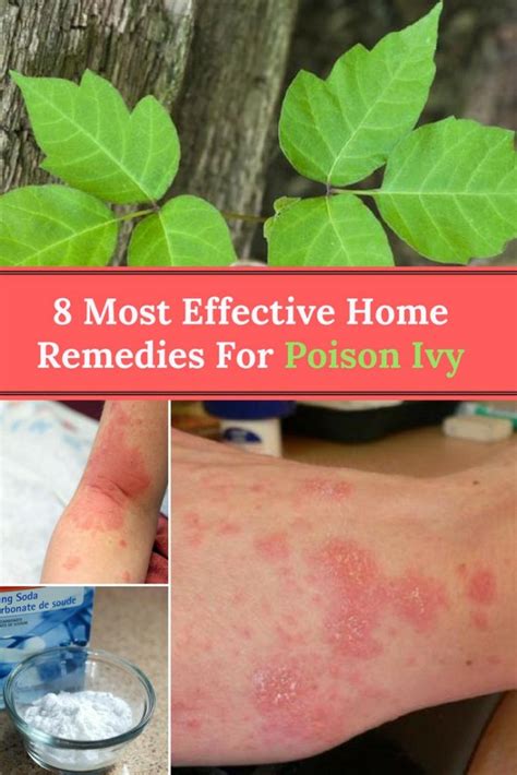 How do you shower when you have poison ivy?