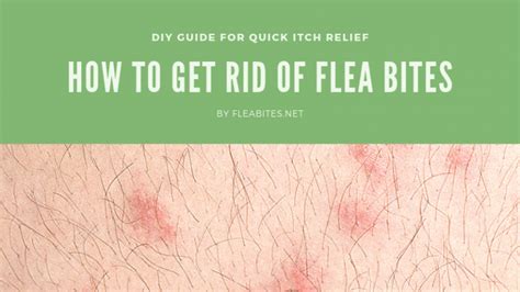 How do you shower with flea bites?