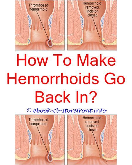 How do you shower with hemorrhoids?