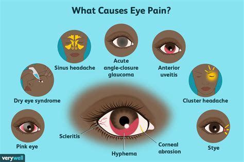 How do you sleep with eye pain?
